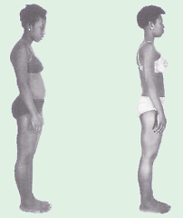 Rolfing to treat muscle pain in Fort Walton Beach, Destin, Niceville, Navarre Florida rolfer